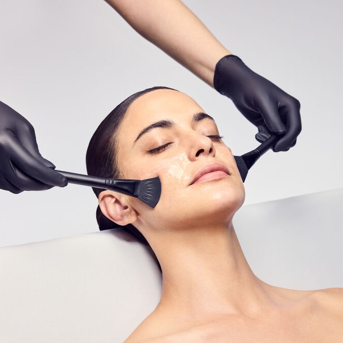 Acid Peel Treatment